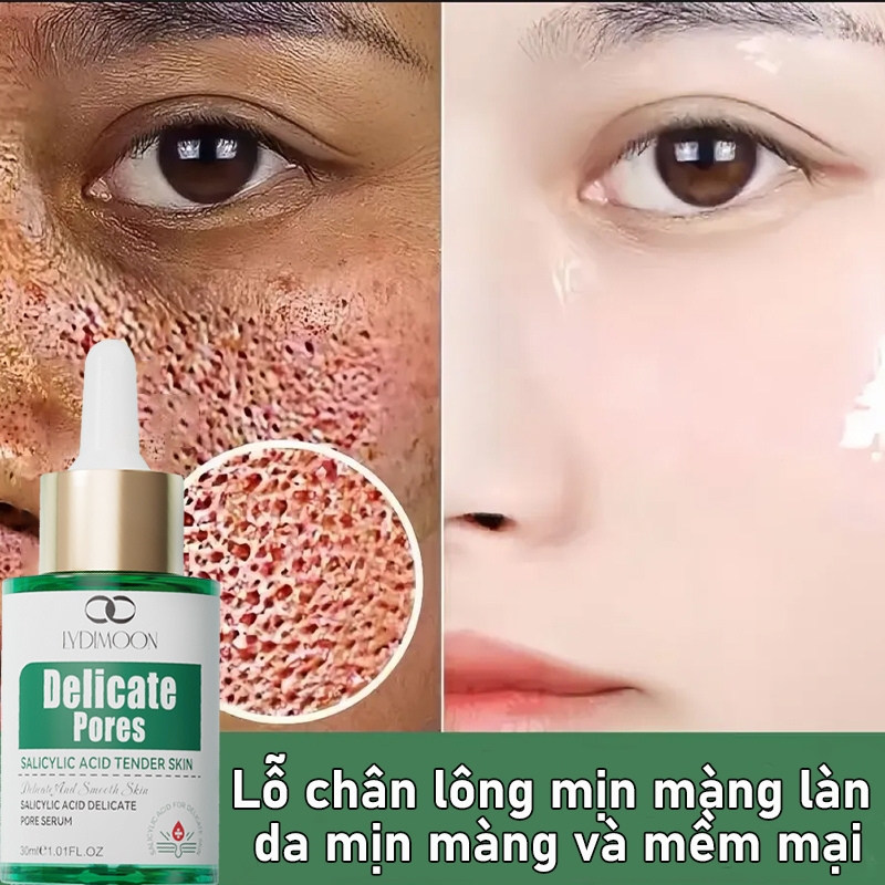Tinh chất axit Salicylic làm giảm mụn trứng cá vết mụn thu nhỏ lỗ chân lông và làm săn chắc da 30ml