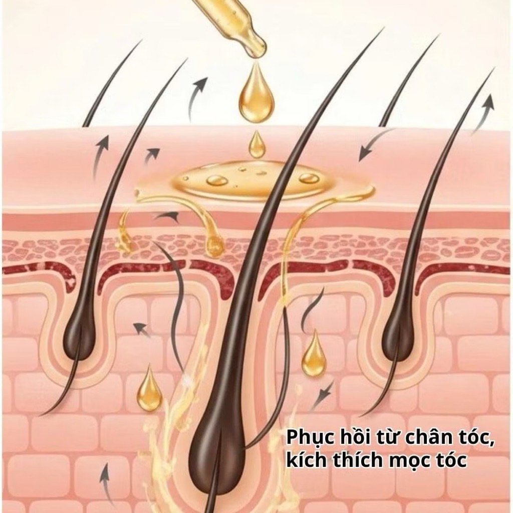 @sushishop94 Tinh Chất Mọc Tóc Thảo Dược Hair Care Greenvibes, Xịt Nuôi Dưỡng Chân Tóc, Giảm Tóc Bạc, Gãy Rụng