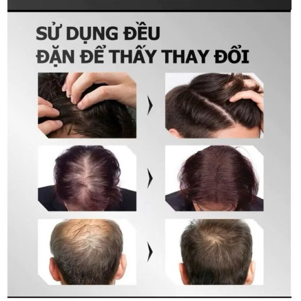 @sushishop94 Tinh Chất Mọc Tóc Thảo Dược Hair Care Greenvibes, Xịt Nuôi Dưỡng Chân Tóc, Giảm Tóc Bạc, Gãy Rụng