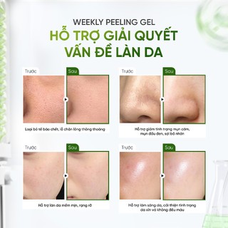 [Combo Sữa Rửa Mặt + Tẩy Tế Bào Chết] DAILY EFFECT Daily Cleansing Gel + Weekly Peeling Gel (120g + 120g)