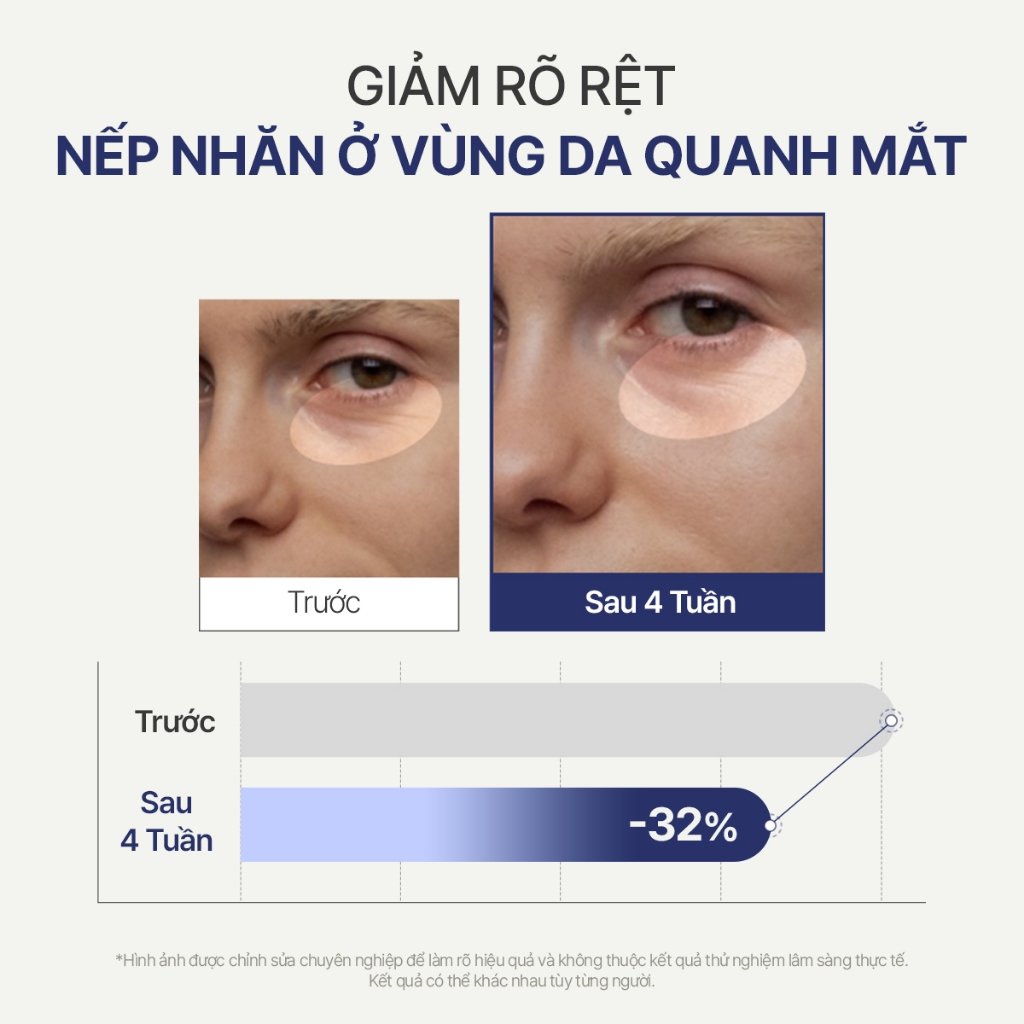 Serum Mắt Giảm Nếp Nhăn & Ngừa Lão Hóa INNISFREE GREEN TEA PDRN EYES SERUM