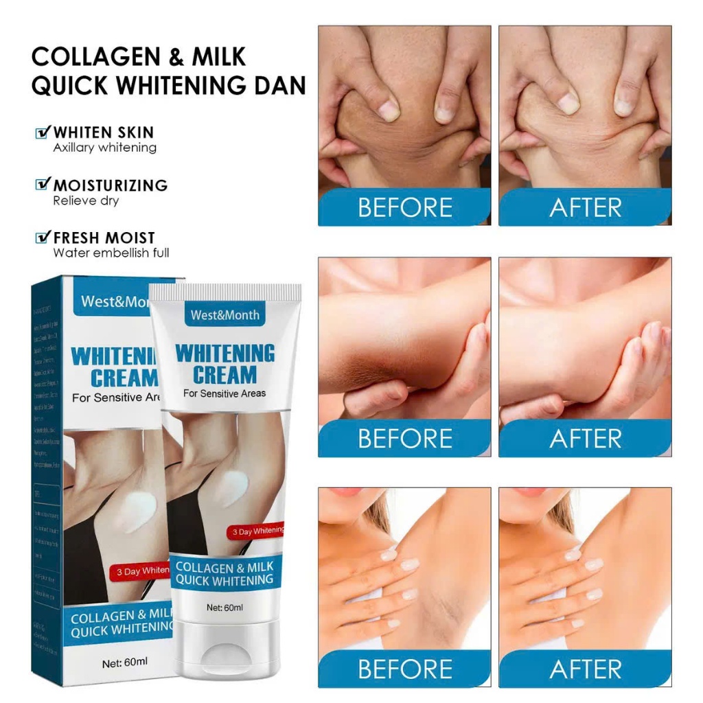 Kem Làm Trắng Nách, giảm thâm mông, Bikini, núm vú, dưỡng và tái tạo da Whitening Cream