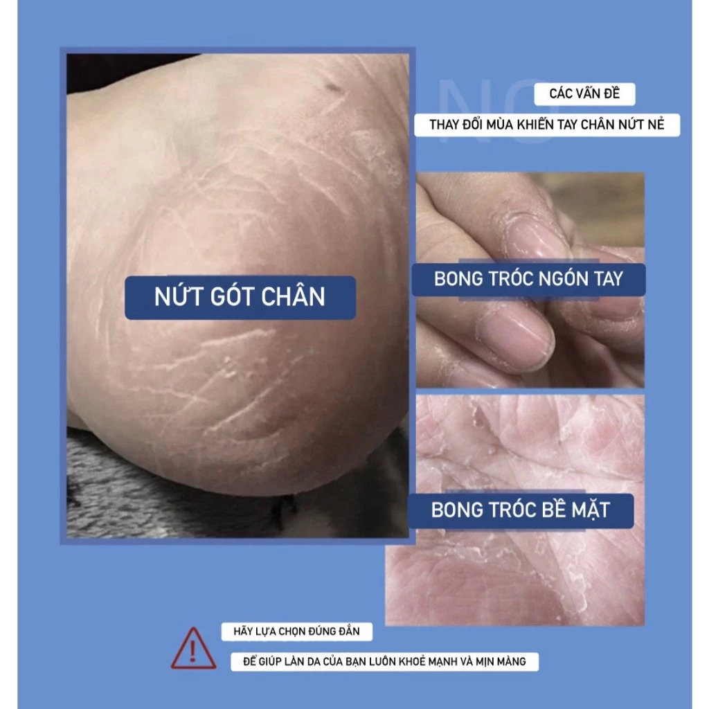 Combo 1-5-10 Kem Dưỡng Ẩm Da Tay Căng Bóng Mềm Mịn Trắng Sáng Phục Hồi Da Hư Tổn Ngăn Chặn Quá Trình Lão Hóa