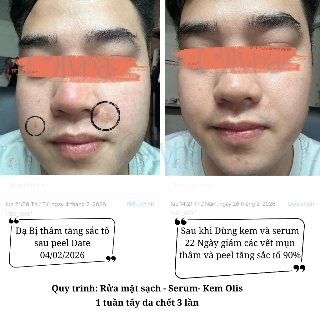 Thiết Kế Của Tinh Chất Serum B5 Ha Olis Cấp Ẩm Phục Hồi Da Nhạy Cảm Tiêu Chuẩn