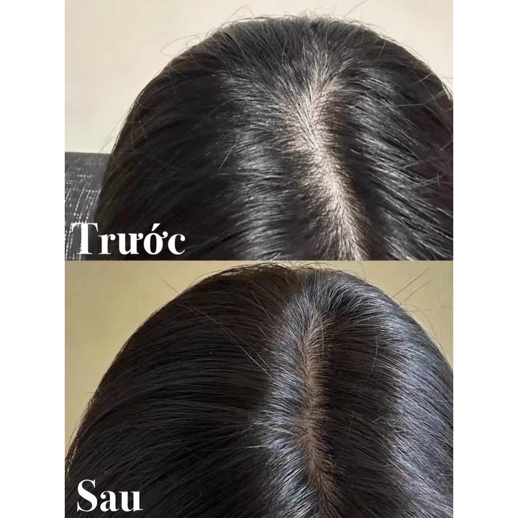 🌿 [HÀNG CHÍNH HÃNG] Xà Phòng Thảo Dược Cỏ Usma Tân Cương - Kiểm Soát Dầu, Ngăn Rụng Tóc Tự Nhiên | An Toàn Cho Da Đầu