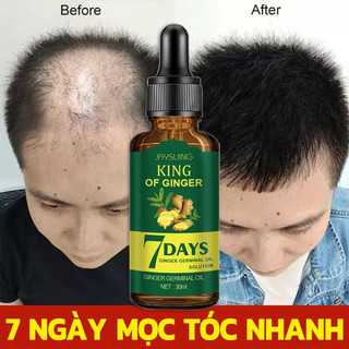 Serum mọc tóc 7 ngày tăng trưởng Tinh chất dưỡng tóc Tinh Chất Chống Rụng Tóc 30ml kích thích mọc tóc nhanh làm dày giúp