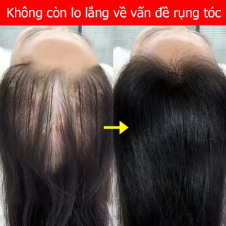 Serum mọc tóc 7 ngày tăng trưởng Tinh chất dưỡng tóc Tinh Chất Chống Rụng Tóc 30ml kích thích mọc tóc nhanh làm dày giúp