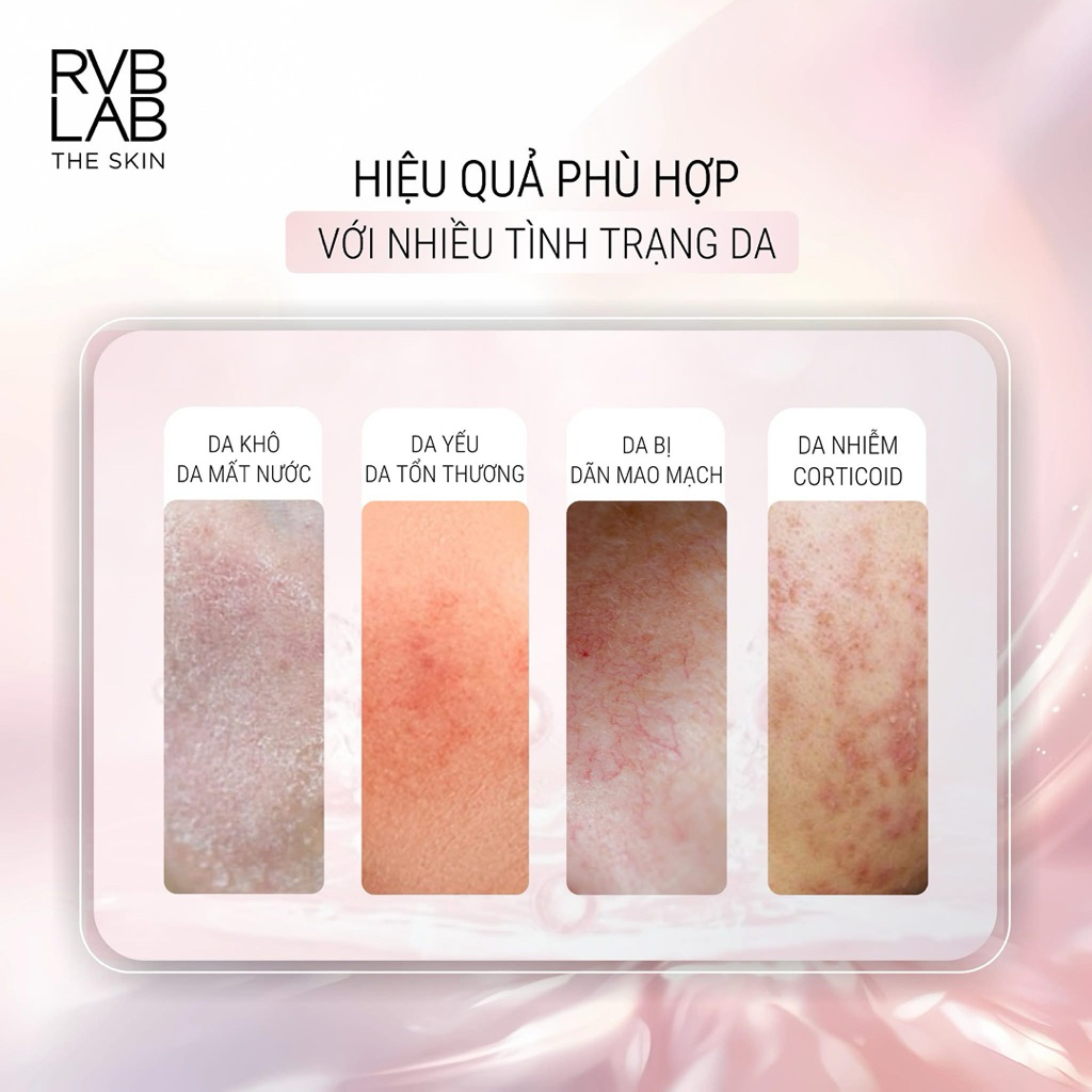 Huyết Thanh Phục Hồi Siêu Lợi Khuẩn RVB LAB Calming Serum - Giải Pháp Cho Da Nhạy Cảm, Giãn Mao Mạch & Nhiễm Corticoid 3