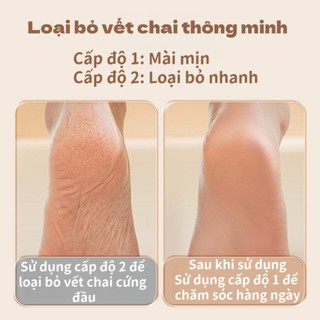 Máy mài chân thông minh | Hiển thị điện lượng, 2 đầu mài, loại bỏ chai da, da chết, tẩy tế bào chết, chăm sóc chân hoàn