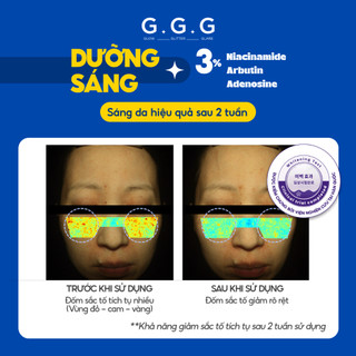[Chỉ còn 2 SPD KOL] Mặt Nạ Gel Lạnh Cooling Mask Hạ Nhiệt -6 Độ, Làm Dịu Da Ửng Đỏ, Sáng Da 50g