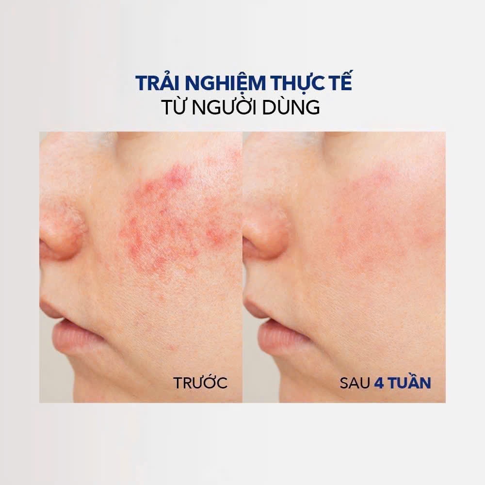 Tẩy da chết IMAGE Skincare CLEAR CELL Clarifying Salicylic Tonic