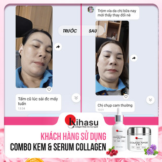Combo Mờ Nám Sáng Da Với Serum và Kem Collagen Kihasu 6in1 Size Lớn Dưỡng Trắng, Ẩm Mịn Ngừa Lão Hóa, Giảm Thâm