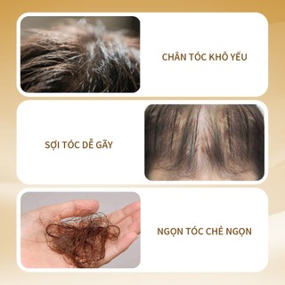Uilicy Dầu Gội Chống Rụng Tóc Không Chứa Silicone Công Thức Chuyên Biệt Cho Tóc Dầu Tạo Bọt Mịn Hương Thơm Cao Cấp Phong