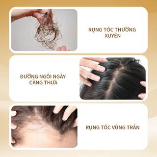 Tinh chất chống rụng UILICY tóc Công thức dịu nhẹ Phục hồi hàng rào bảo vệ da đầu Bảo vệ tóc khỏi hư tổn do nhiệt