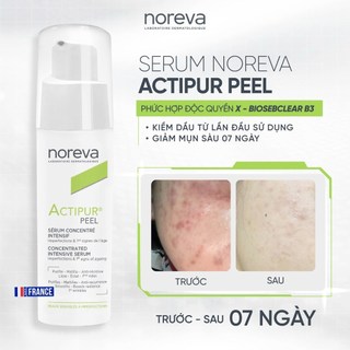 Serum Noreva Actipur Peel Concentrated 30ml – Kiềm Dầu, Giảm Mụn Cho Da Dầu Mụn & Da Nhạy Cảm
