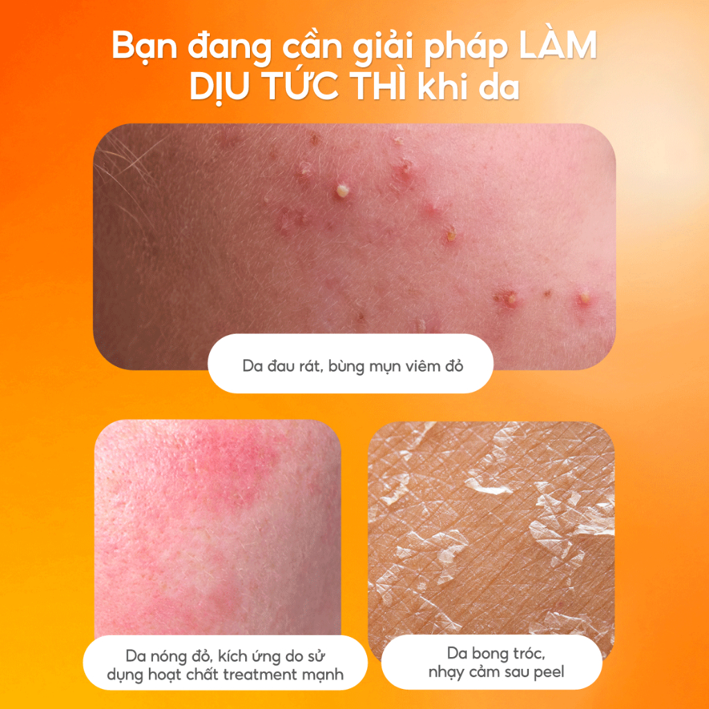 Combo Toner Nấm 200ml & Kem Nấm 50g G.G.G - Cấp Ẩm Chuyên Sâu, Tái Tạo Da Căng Mượt và Giảm Nếp Nhăn G.G.G