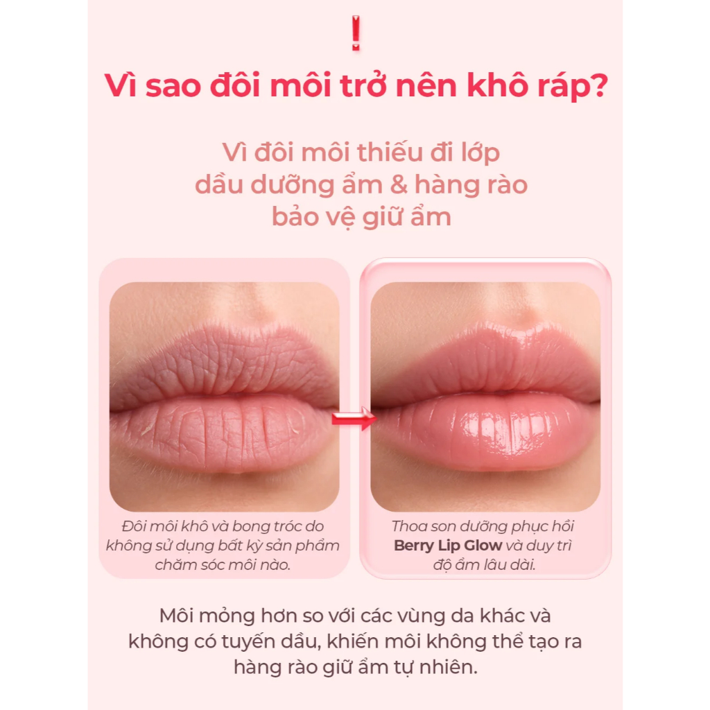 Son dưỡng môi mềm mịn, căng mọng ngừa nứt nẻ Care:nel Berry Lip Glow 10g