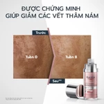 Tinh chất giảm thâm nám & dưỡng sáng Eucerin Spotless Brightening Booster Serum 30ml | Serum mờ thâm sáng da | Skincare — ảnh 5