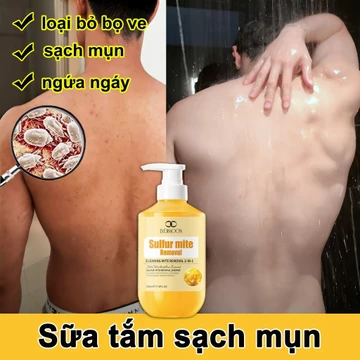Sữa tắm xoá mụn lưng 500ml Sữa tắm lưu huỳnh sạch mụn giảm ngứa sữa tắm viêm nang lông