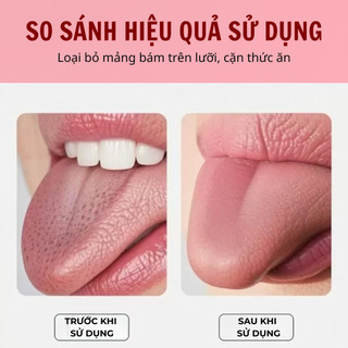 [MUA 1 TẶNG 1] Bộ 2 Cây Cạo Lưỡi Inox Cao Cấp – Kèm Hộp Đựng, An Toàn, Chăm Sóc Răng Miệng Hiệu Quả