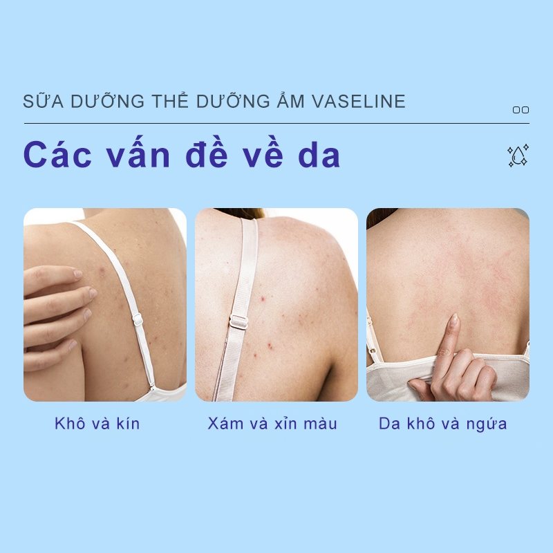 Sữa Dưỡng Thể Vaseline Dưống Am Chuyên Sâu Dưỡng Trắng Chống Khô Da Chăm Sóc Dịu Nhe Mùi Hương Độc Quyền 500ML