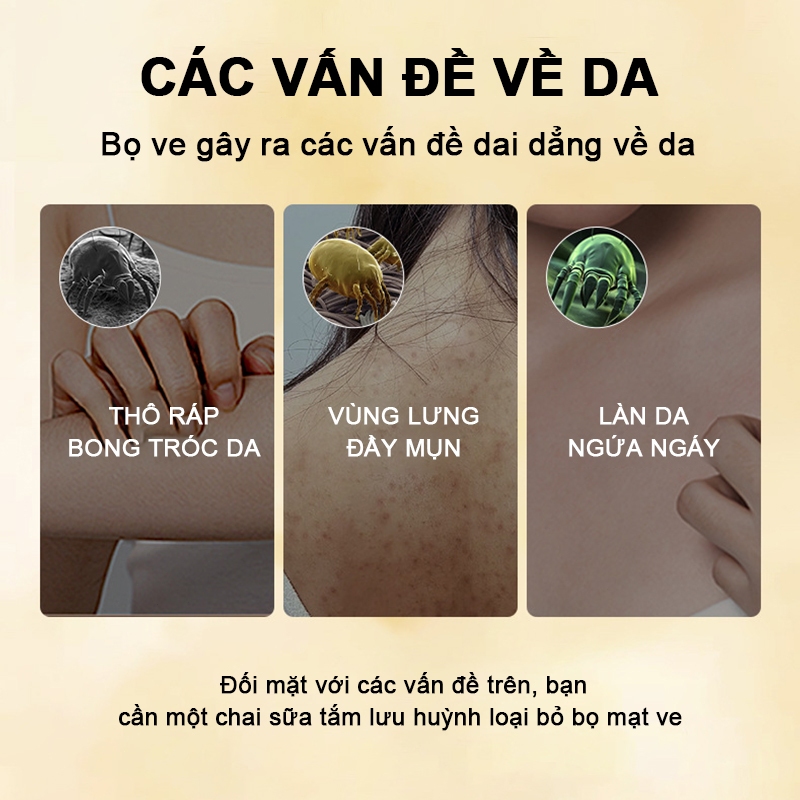 Sữa tắm lưu huỳnh SADOER Sữa tắm viêm nang lông Kháng Khuẩn Da Và Giảm Mụn Lưng Mờ Thâm, Làn Da Sạch Mịn 500ML