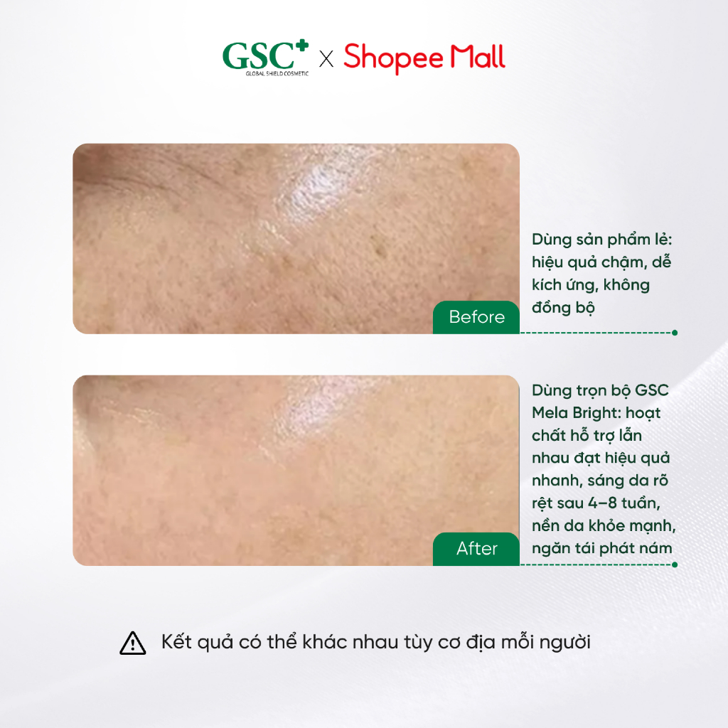 Bộ Sản Phẩm Dưỡng Sáng, Mờ Thâm Nám GSC Mela Bright gồm 3 Sản Phẩm - Ngắn Ngừa Nám Tái Phát  - S4