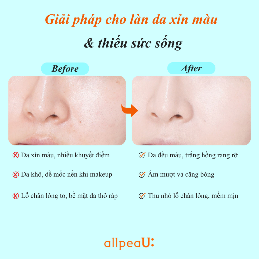 Tinh Chất Dưỡng Ẩm allpeaU: 10ml Hàn Quốc – Cấp Ẩm Tức Thì, Da Mịn Sáng, Không Kích Ứng