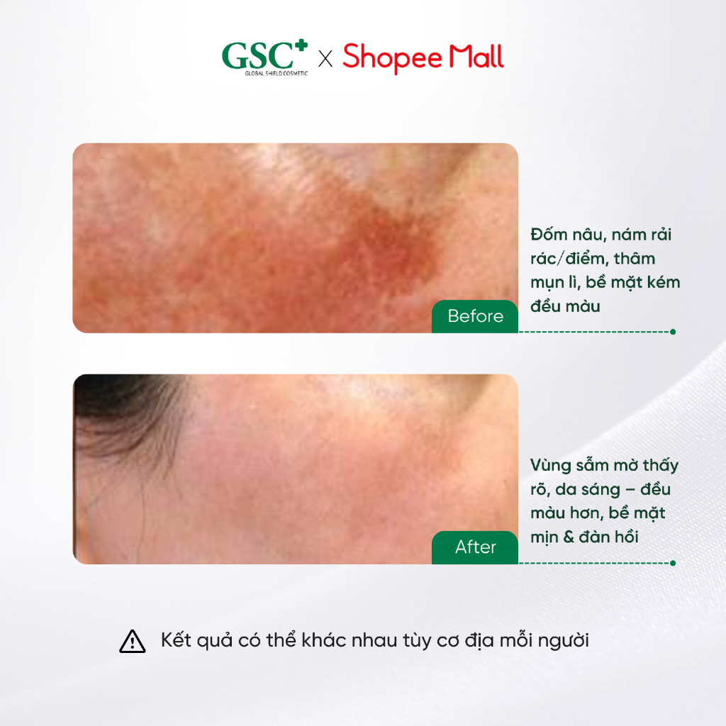 Kem Dưỡng Sáng Da, Mờ Thâm Nám GSC Mela Bright Spot Corrector 30ml - GC105A