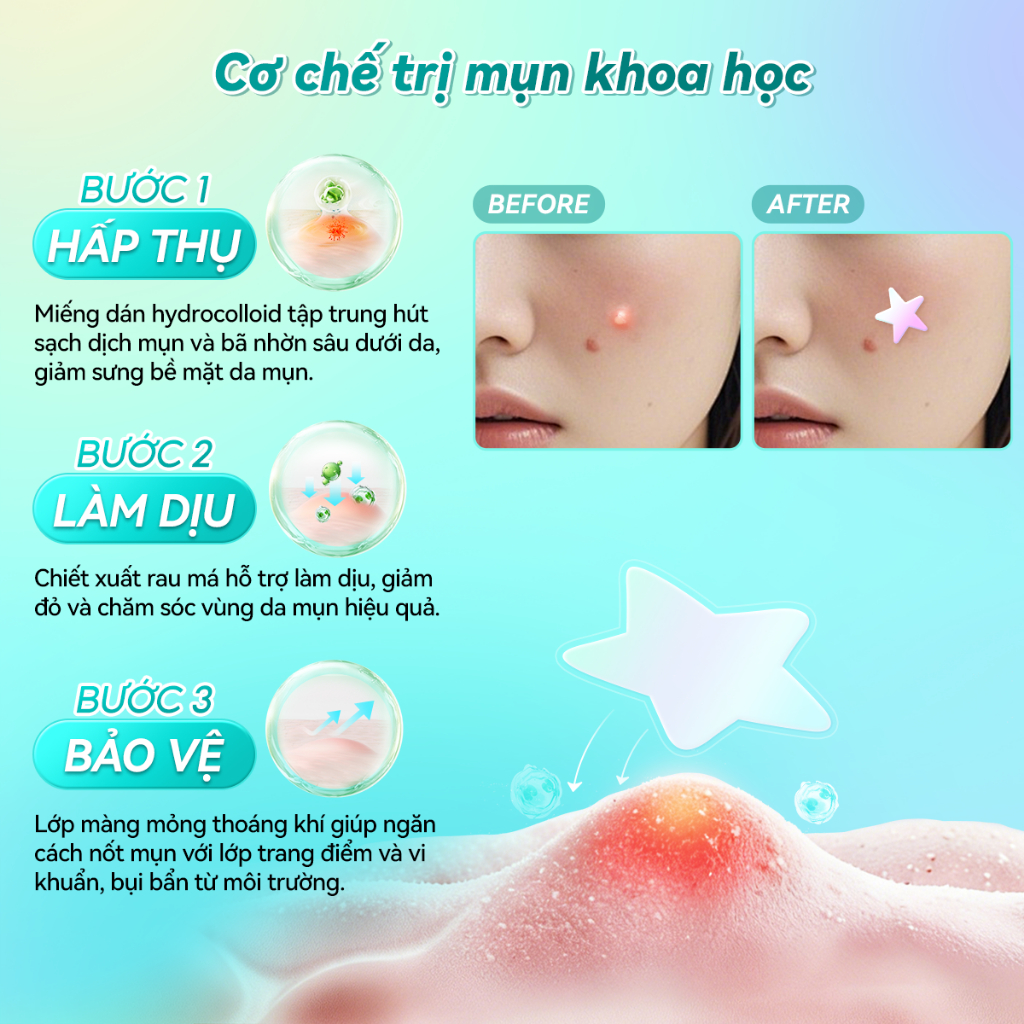 LANBENA 【MOH】Miếng dán mụn - trong suốt hỗ trợ giảm mụn lành sẹo mụn dùng mỗi ngày dán mụn ban ngày & ban đêm Skincare