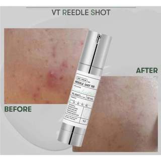Tinh chất reedle shot 100 30ml