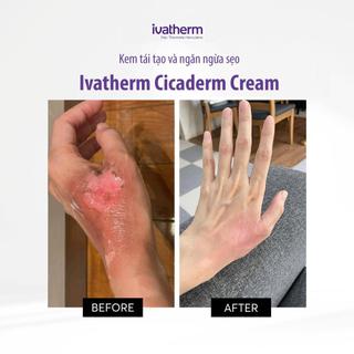 Kem Dưỡng Phục Hồi, Tái Tạo Da Và Ngăn Ngừa Hình Thành Sẹo Ivatherm Cicaderm Cream
