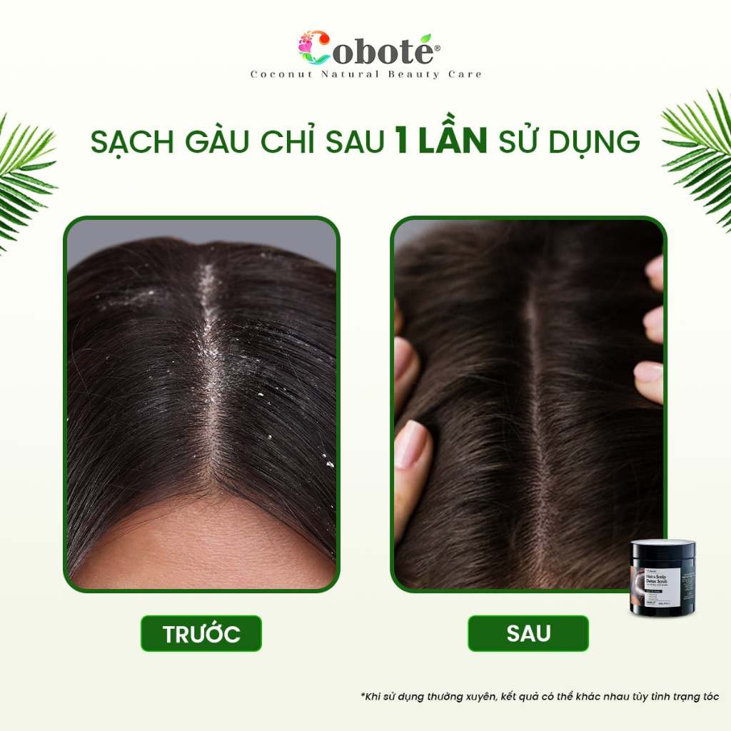 Muối tẩy tế bào chết cho da đầu sạch gàu, giảm ngứa, thành phần an toàn lành tính 75gr/265gr