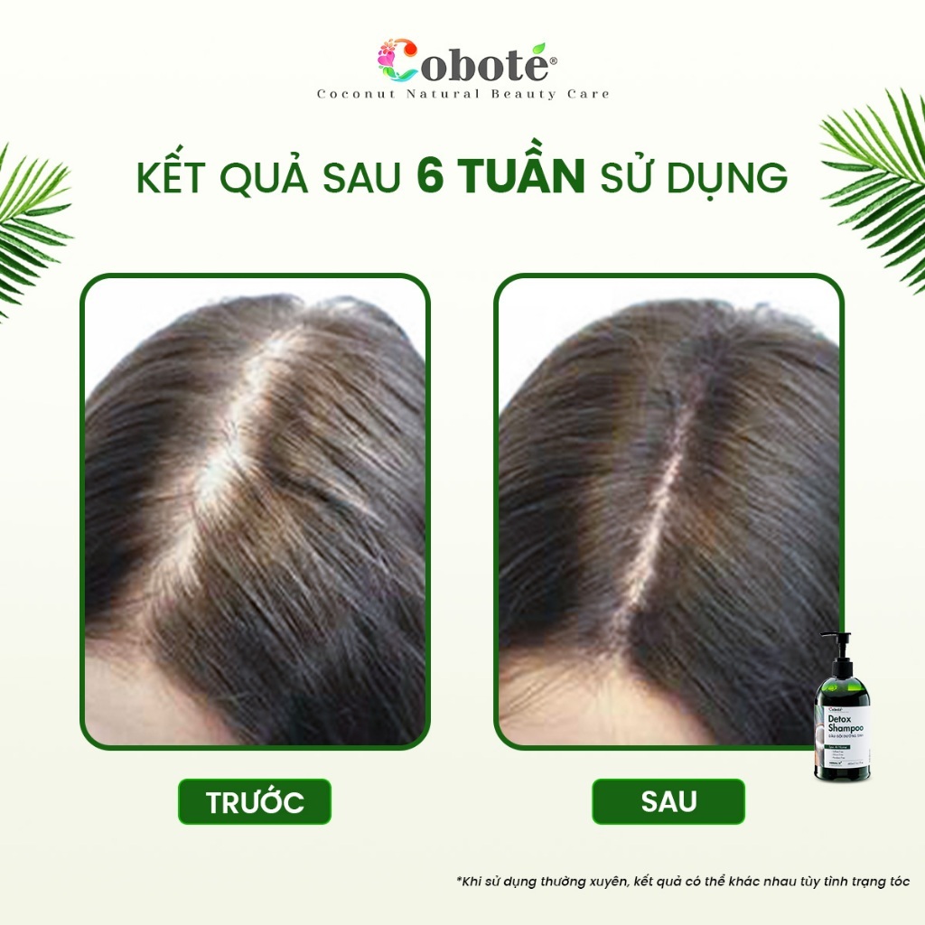 Dầu gội kích thích mọc tóc, làm phồng tóc Coboté Detox – Giúp tóc dày, khỏe, giảm rụng 100ml/480ml