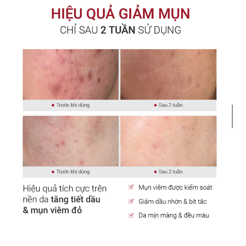 [ĐẠI LÝ CHÍNH HÃNG] Tinh chất Fusion Retinol 1.0 (New version - 0.3% Retinol) dành riêng cho da dầu mụn 30ml