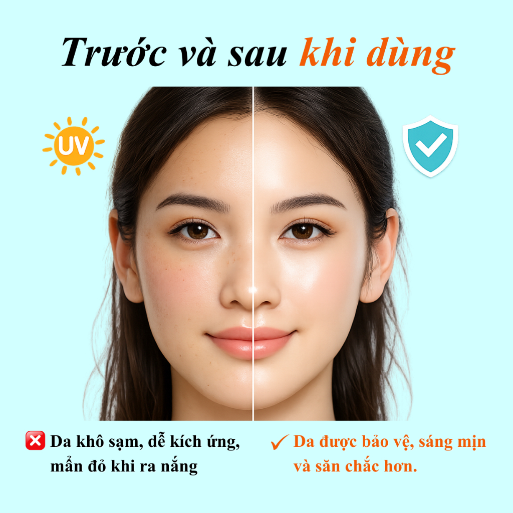Kem Chống Nắng Hàn Quốc SPF50+ PA++++ |10ml/50ml| Mỏng Nhẹ, Thấm Nhanh, Không Bết Dính|allpeaU: