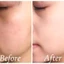 Kem Dưỡng Bakuchiol 2% CoK’lear 30ml