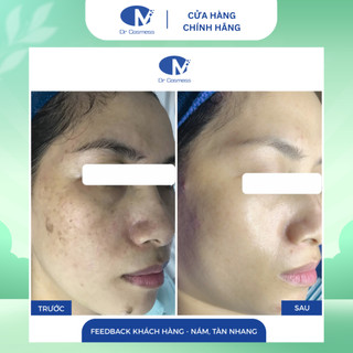 Sữa Rửa Mặt Cho Da Nám, Sạch Sâu, Độ Ph Cân Bằng, Dưỡng Sáng Da, Dịu Nhẹ, Lành Tính Dr Cosmess 100ml
