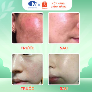Kem Chống Nắng Phổ Rộng SPF50+/PA++++ Dịu Nhẹ, Không Cay Mắt, Không Kích Ứng 50ml Dr Cosmess
