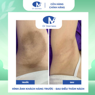 Tặng Kèm Nước Cân Bằng | 100% Chính Hãng | Peel Nách, Giảm Thâm Blue Peel Dr Cosmess 30ml Chính Hãng