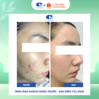 Serum Tẩy Tế Bào Chết  AHA, Sạch Sâu Lỗ Chân Lông & Mụn, Ngừa Bít Tắc, Không Kích Ứng 40ml DrCosmess