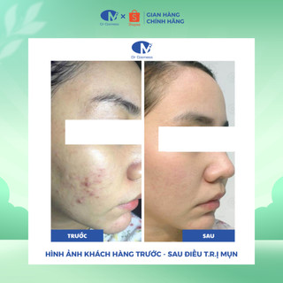 TRỢ GIÁ | Serum AHA BHA Làm Sạch Da, Hỗ Trợ Thoáng Lỗ Chân Lông, Dưỡng Da Mịn Màng 30ml – Dr Cosmess
