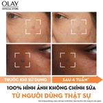 [LS] Combo 2 Super Serum OLAY 5 Dưỡng Chất Trong 1 30ml Và Kem Dưỡng Ẩm OLAY LUMINOUS NIACINAMIDE + VITAMIN C 50G — ảnh 7