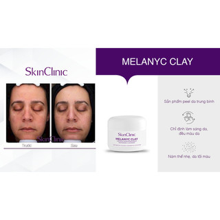 Peel Melanyc Clay K dành cho da nám lâu năm dùng trong spa Mẫu Thử