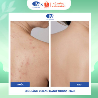 Sữa Tắm Giảm Mụn Lưng, Mụn Body, Viêm Nang Lông - AHA BHA, Ngừa Thâm 300ml Dr Cosmess Chính Hãng