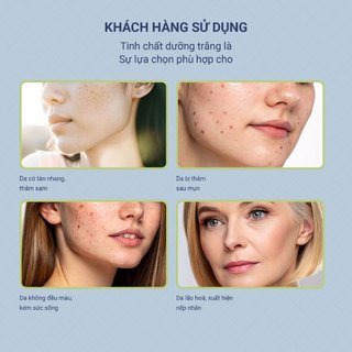 Combo serum và kem dưỡng sáng, làm mờ thâm nám, thâm mụn, hỗ trợ đều màu da Care:nel Anti Melasma