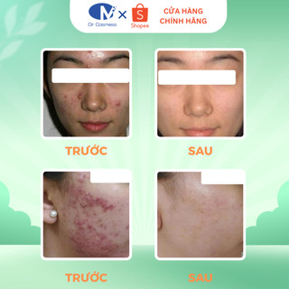 TRỢ GIÁ | Sữa Rửa Mặt Cho Mọi Loại Da, Làm Sạch Sâu, Nhờn, Bụi Bẩn, Không Kích Ứng 100ml  Dr Cosmess