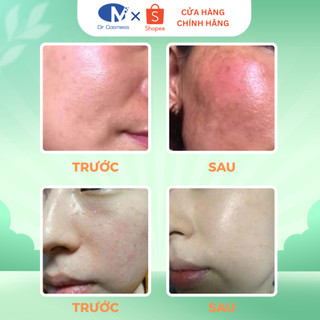 Kem Hồng Nhũ Hoa, Dưỡng Sáng Hồng Tự Nhiên, An Toàn, Hiệu Quả, Không Kích Ứng 15g Dr Cosmess