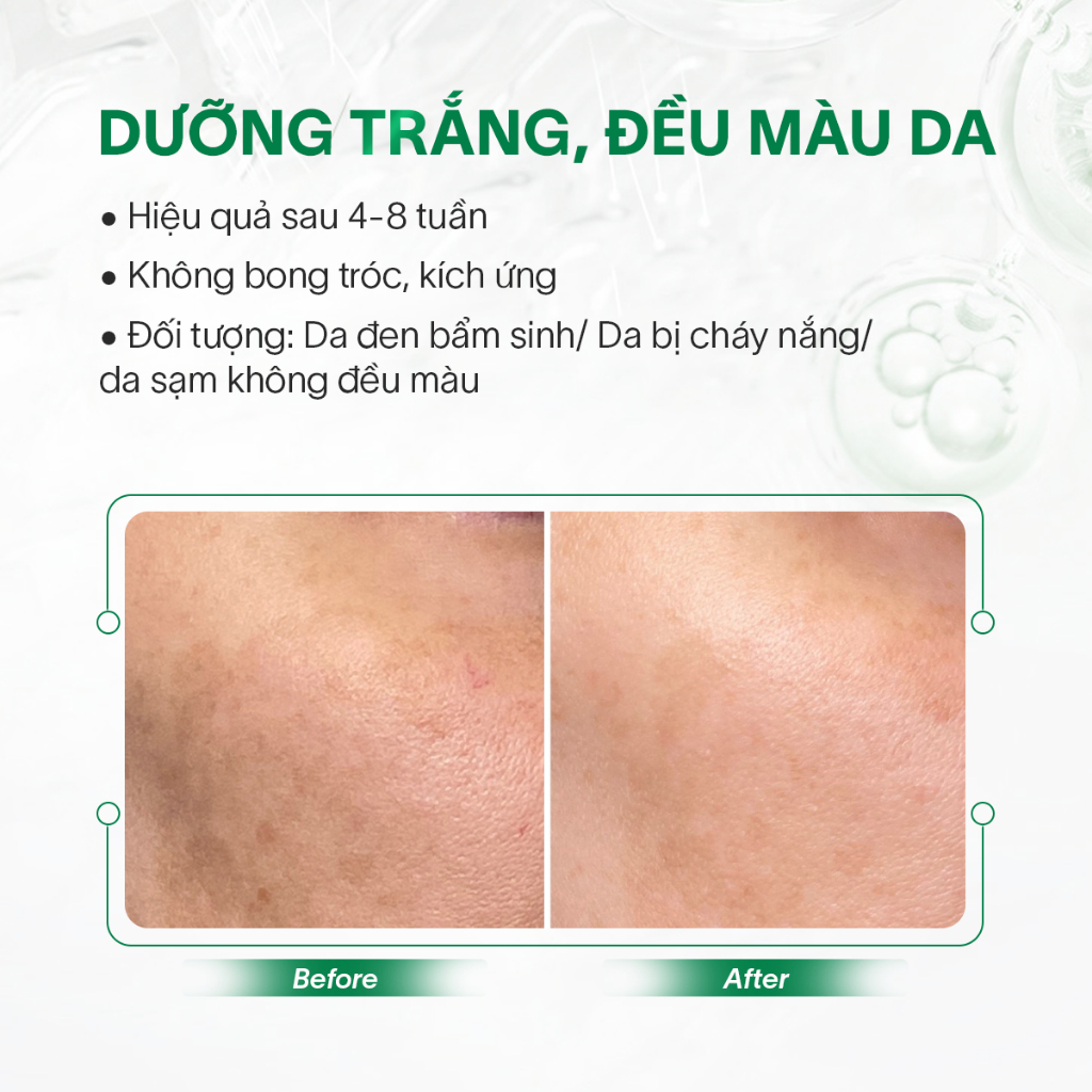 Serum trắng da mờ nám GSC GV Whitening Ampoule từ tế bào gốc thực vật 8ML - GC086A