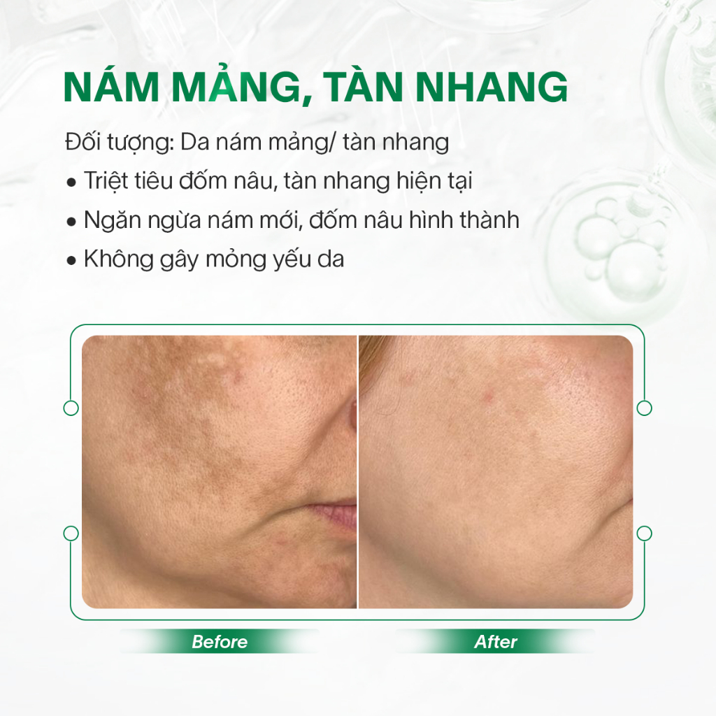 Serum trắng da mờ nám GSC GV Whitening Ampoule từ tế bào gốc thực vật 8ML - GC086A
